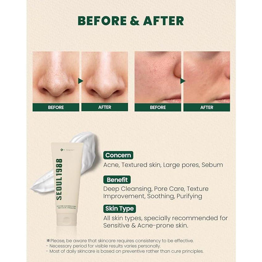 SEOUL 1988 Cleansing Foam : Pine Cica 1% + Probiotics