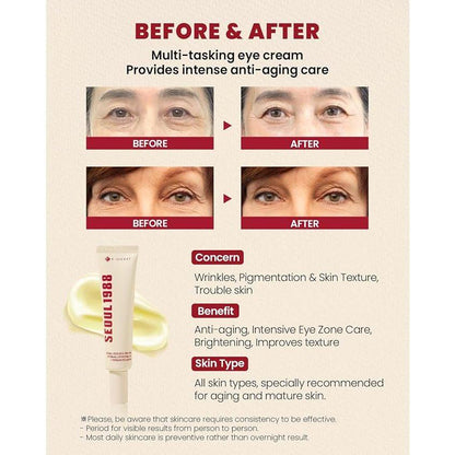 K-Secret Seoul 1988 Eye Cream : Retinal Liposome 4% + Fermented Bean - Anti-Aging & Fine Lines Korean Firming Eye Cream