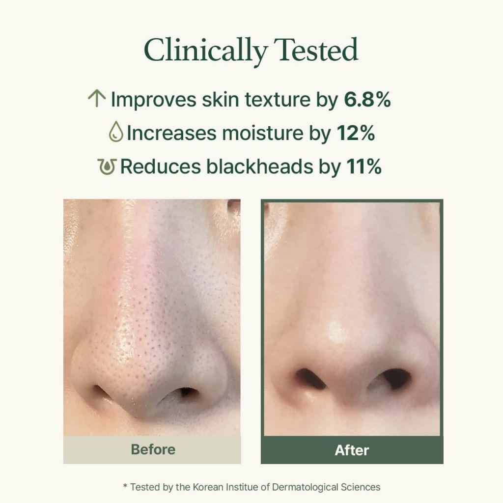 Arencia Fresh Green Cleanser - Deep Pore Rice Cleanser for Oily & Acne-Prone Skin