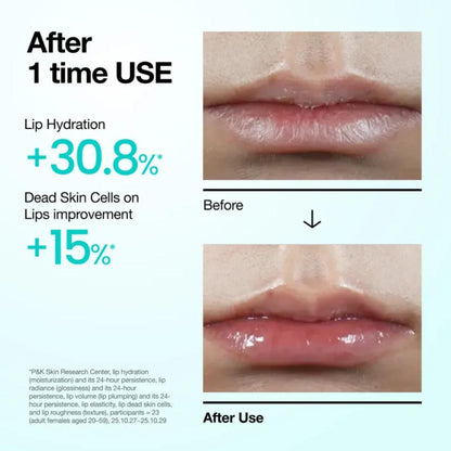 Anua PDRN Lip Serum 10ml - Hydrating & Repairing Lip Treatment for Smooth, Plump Lips