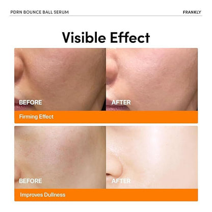 Frankly PDRN Bounce Ball Serum (Skin Repair, Sensitive, Niacinamide, Salmon PDRN)