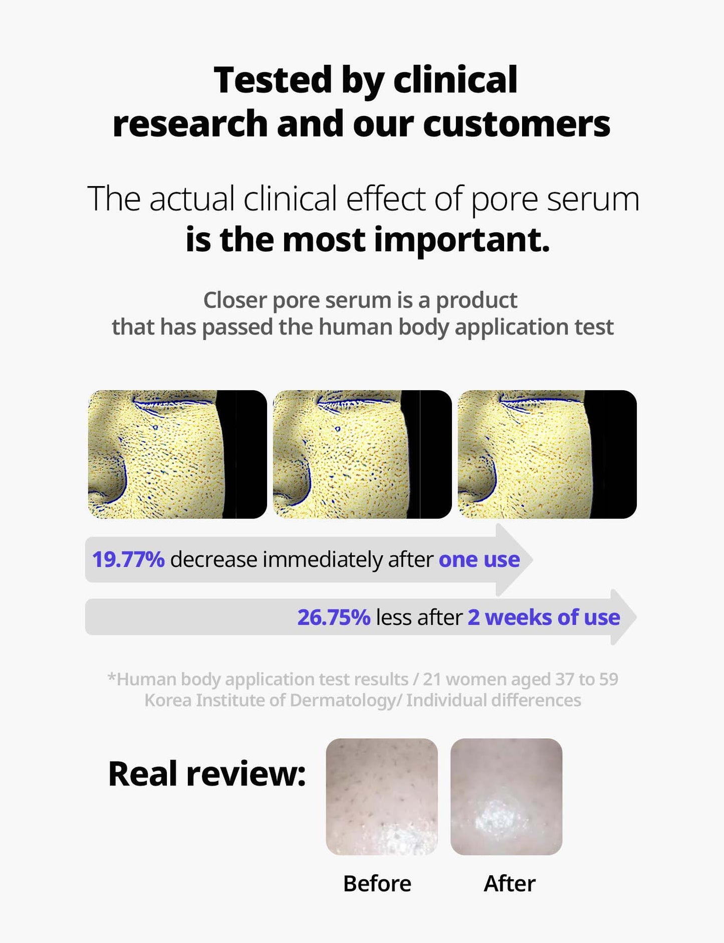 Frankly Closer Pore Reducing Serum - Pore Minimizer and Anti-aging - 9 Kinds of Peptides
