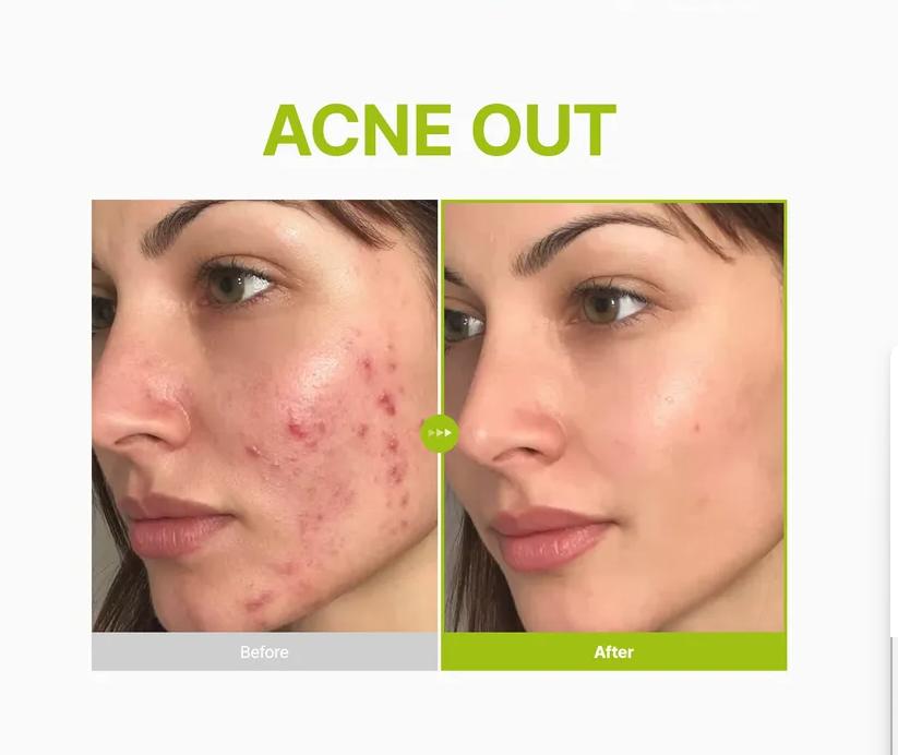 Purito Azelaic Acid 10 Kojic Tea Tree Serum 30ml