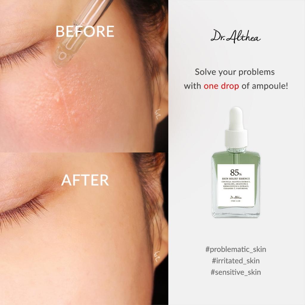 Dr. Althea Skin Relief Essence