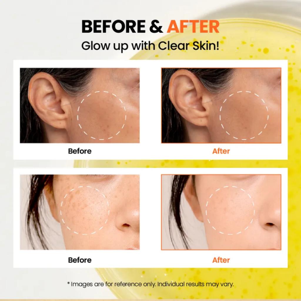 SEOUL 1988 Glow Serum : Niacinamide 15% + Yuja