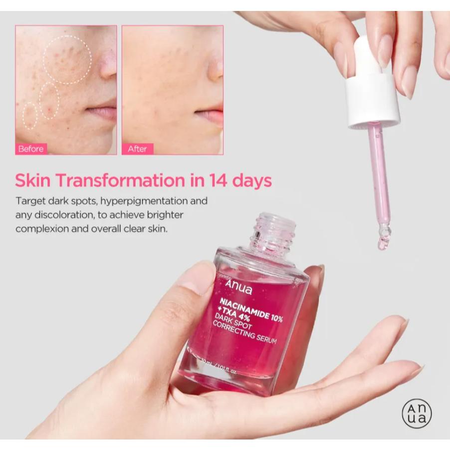 Anua Niacinamide 10% + TXA 4% Dark Spot Serum – Brightening for Acne Marks & Uneven Skin Tone