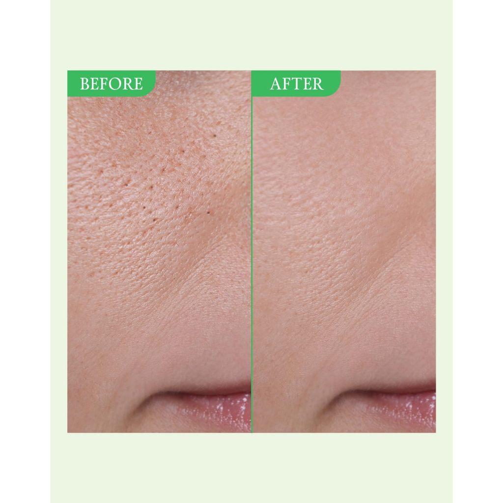 Fully Green Tomato Serum 30ml