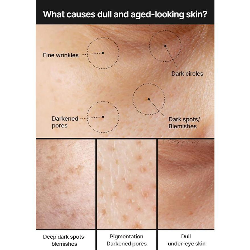 Celimax Pore+Dark Spot Brightening Cream 35ml - Dark Spots & Pore Minimizing Korean Moisturizer