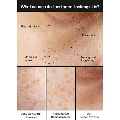 Celimax Pore+Dark Spot Brightening Cream 35ml - Dark Spots & Pore Minimizing Korean Moisturizer