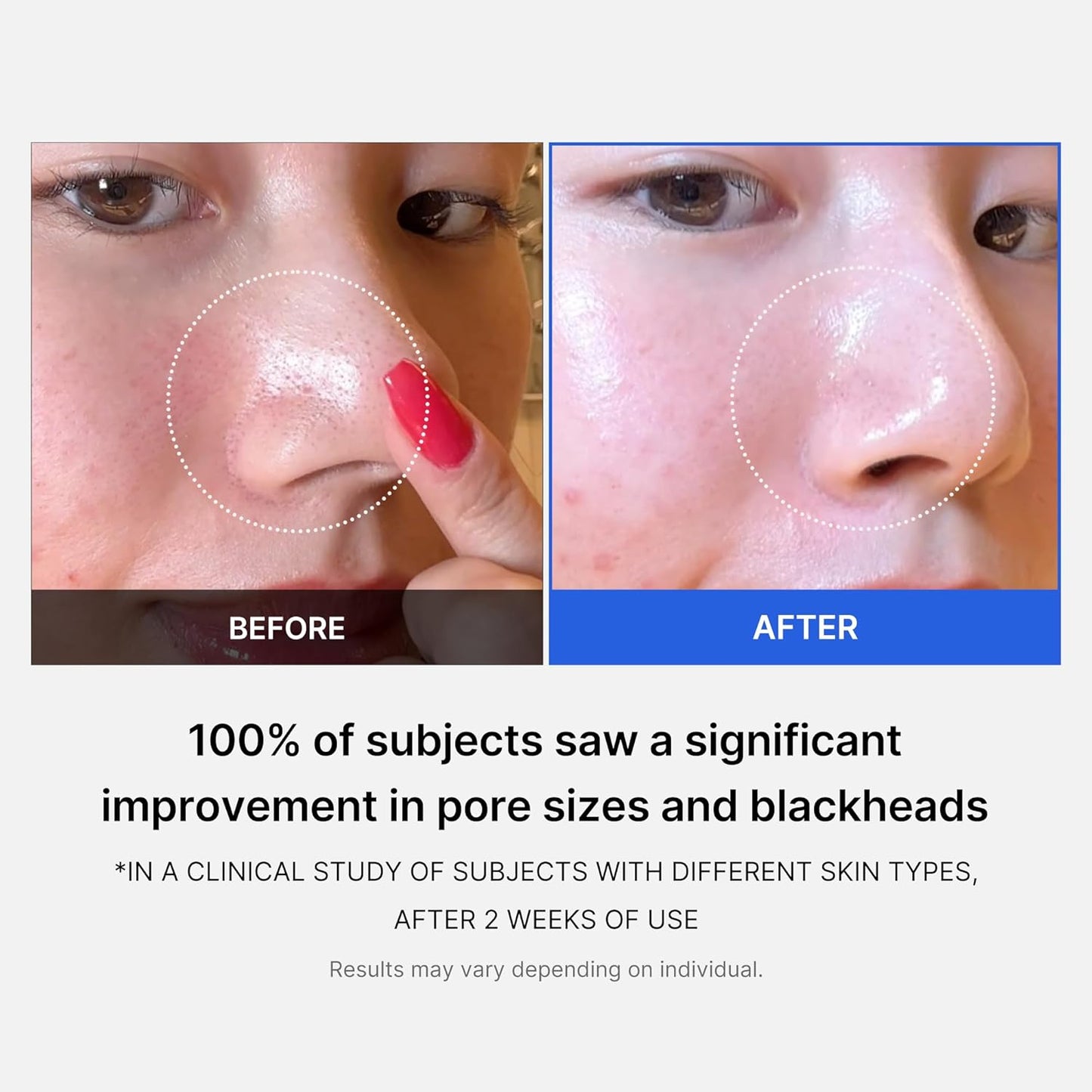 Medicube Zero Pore Pad 2.0 | Pore Pad Mild