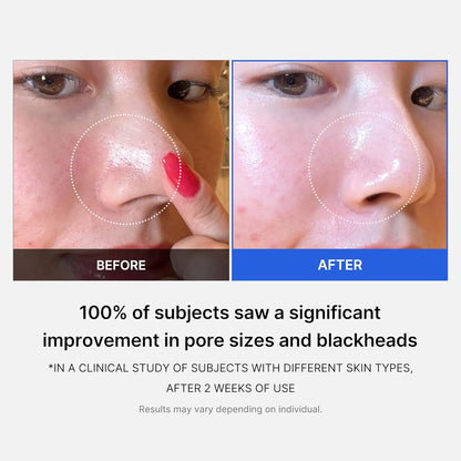 Medicube Zero Pore Pad 2.0 | Pore Pad Mild