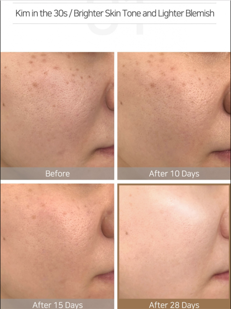 Before and After of Some By Mi Galactomyces Pure Vitamin C Glow Toner Media 4