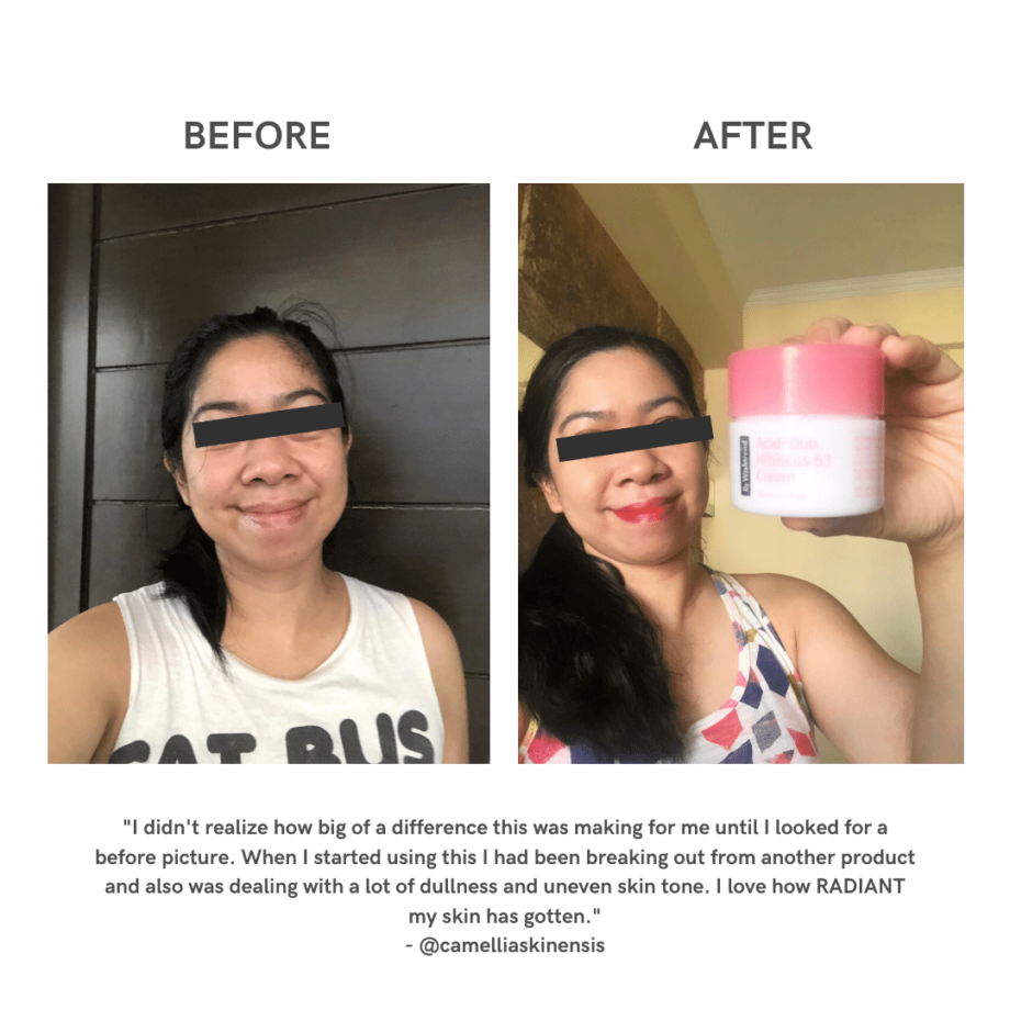 Before and After of By Wishtrend Acid-Duo Hibiscus 63 Cream in Instagram Media 5