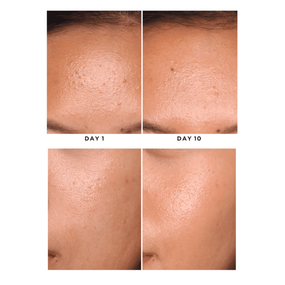 Before and After of By Wishtrend Mandelic Acid Skin Prep Water Media 1