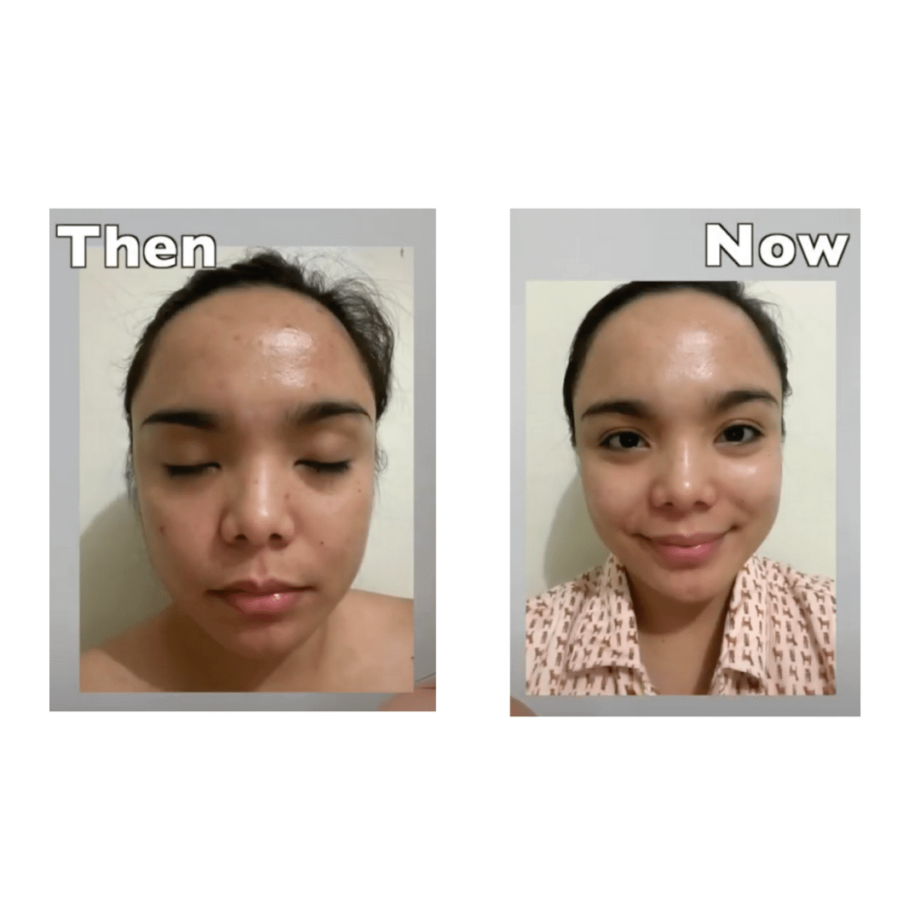 Before and After of By Wishtrend Pure Vitamin C 21.5% Advanced Serum Media 4
