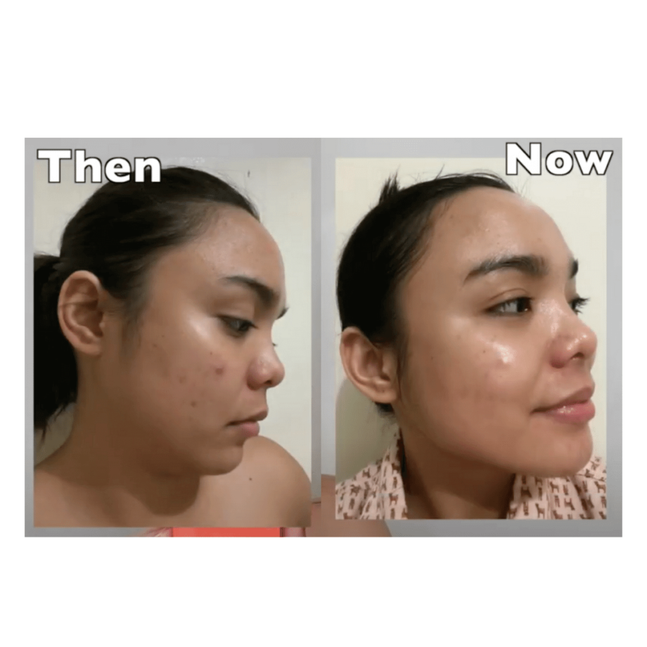Before and After of By Wishtrend Pure Vitamin C 21.5% Advanced Serum Media 2