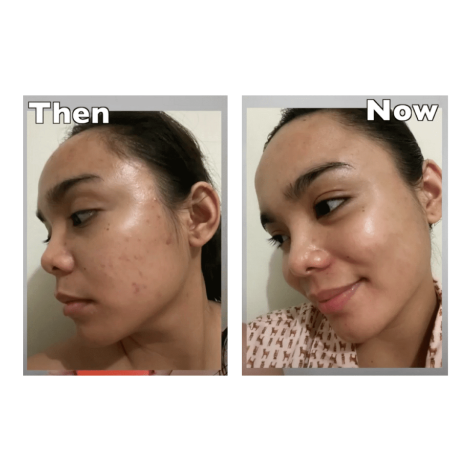 Before and After of By Wishtrend Pure Vitamin C 21.5% Advanced Serum Media 1