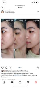 Before and After of By Wishtrend Quad Active Boosting Essence Media 1